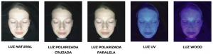analisis y diagnostico facial profesional de la piel con more me de metis en belium estetica gijon